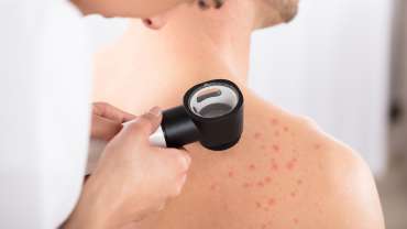 Dermatoscopia e Tricoscopia